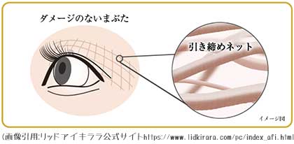 瞼の引き締めネット